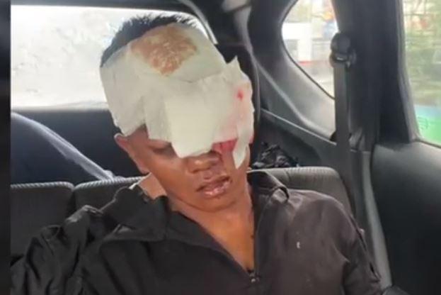 Mata Prajurit TNI Buta usai Dikeroyok Geng Motor di Medan, 2 Pelaku Ditangkap