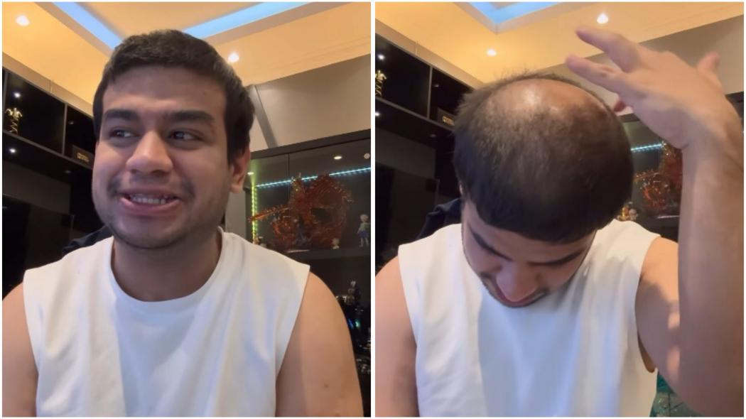 Fadil Jaidi Alami Kebotakan di Usia 29 Tahun, Penyebabnya Suka Bleaching Rambut