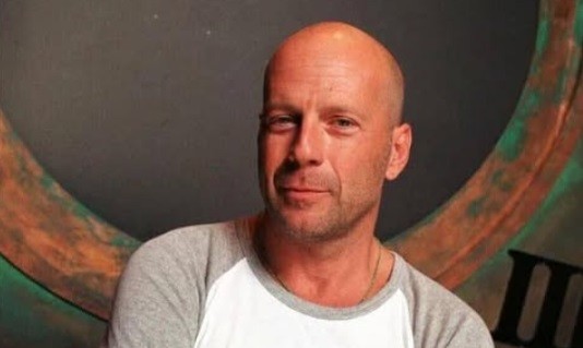 Bruce Willis Terkena Demensia hingga Kondisi Kesehatannya Memburuk: Tak Bisa Bicara dan Kesulitan Berjalan