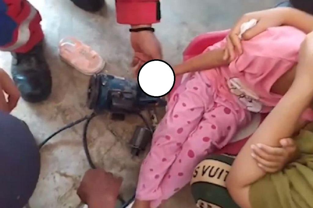 Tangis Bocah Perempuan di Gowa Pecah, Jari Terjepit Mesin Pompa Air Selama 2 Jam!