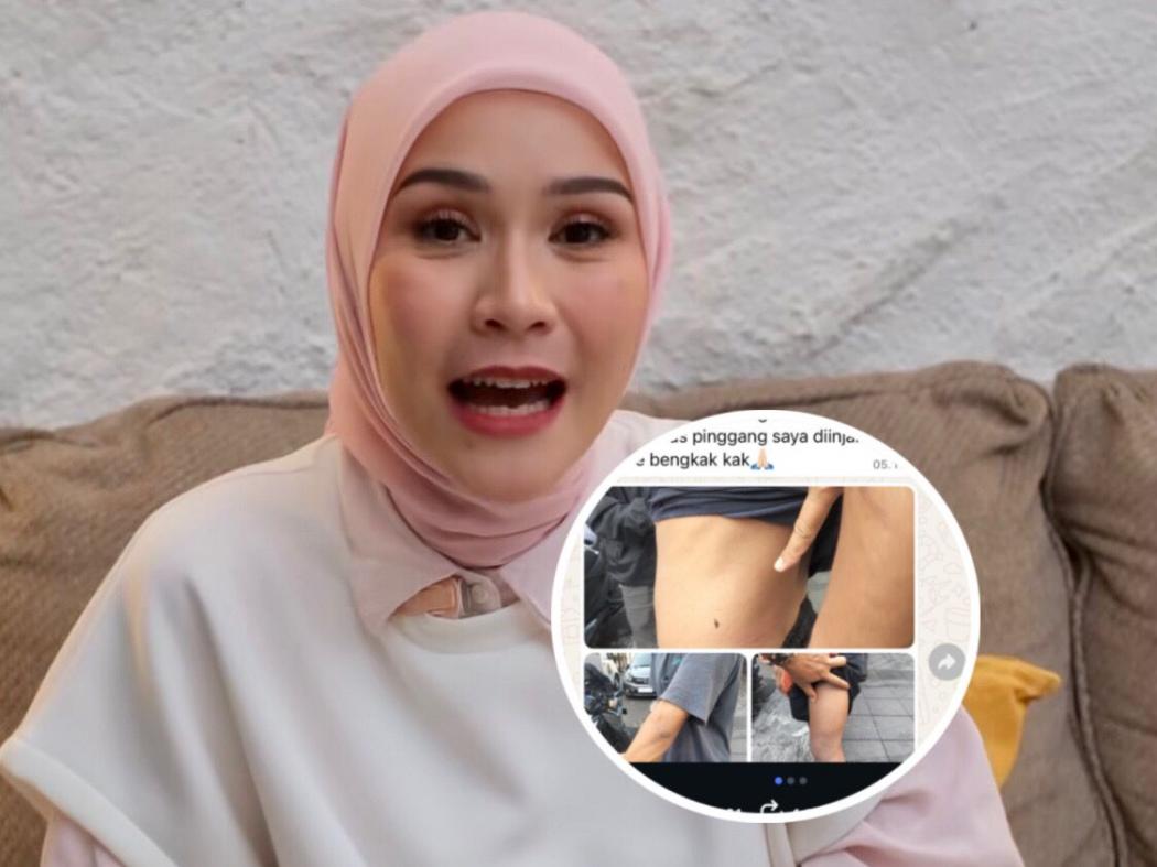 Fakta Baru! Oknum TNI yang Aniaya ART Zaskia Mecca Akhirnya Diamankan