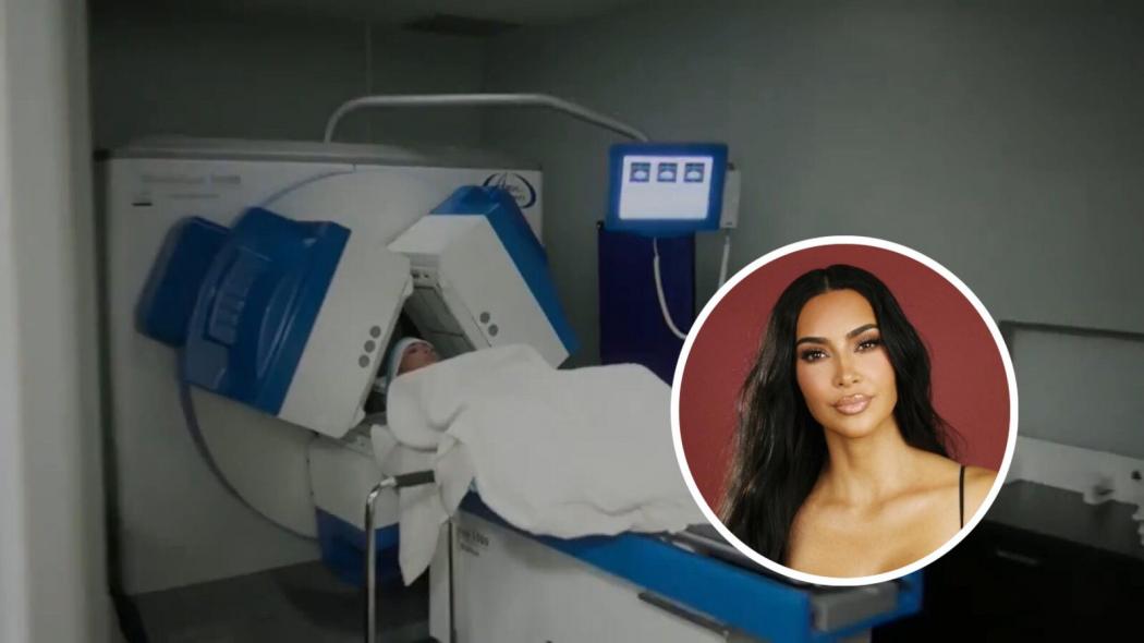 Apa Itu Aneurisma, Penyakit yang Diidap Kim Kardashian?