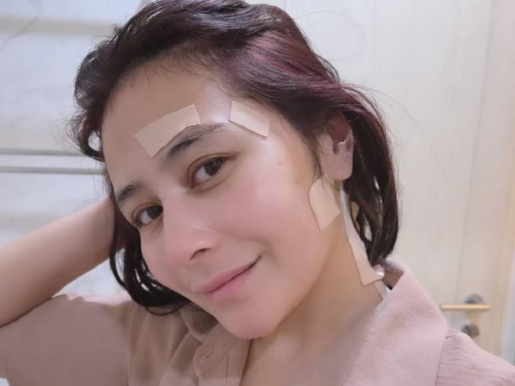 Heboh Prilly Latuconsina Pakai Koyo di Wajah dan Leher, Ini Penyebabnya!