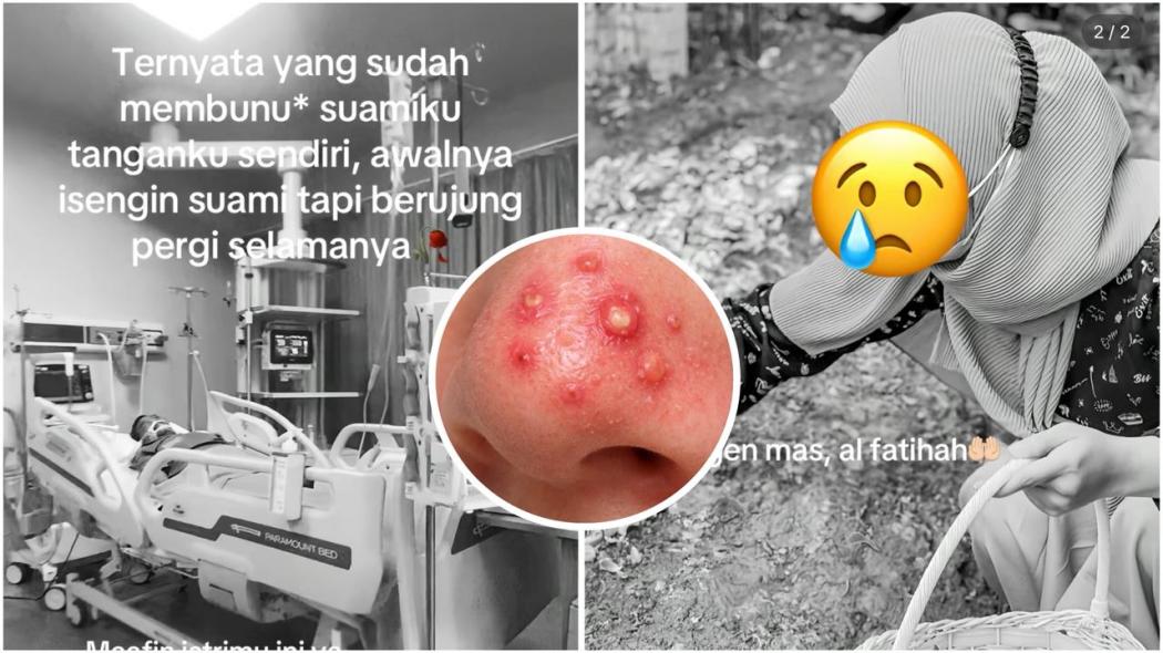 Kronologi Lengkap Istri Pencet Jerawat Suami Berujung Meninggal Dunia, Kisahnya Menyedihkan