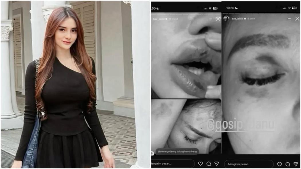 Kronologi Lengkap Selebgram Aprillya Nabilla Dipukuli sampai Biru-Biru hingga Diancam Dibunuh!