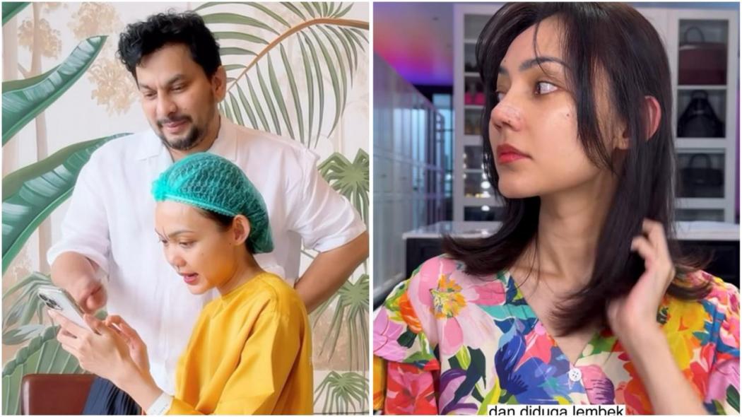 Mengejutkan! Ini Alasan Rina Nose Oplas Hidung dengan Dokter Tompi