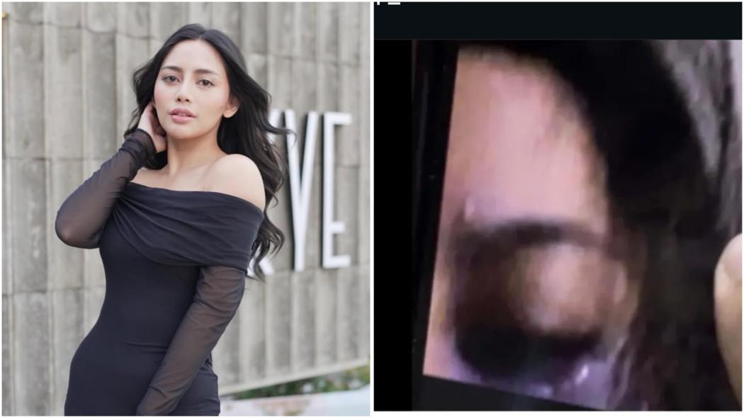 Rachel Vennya Diduga Alami Kekerasan Fisik hingga Mata Bonyok, Faktanya Mengejutkan!