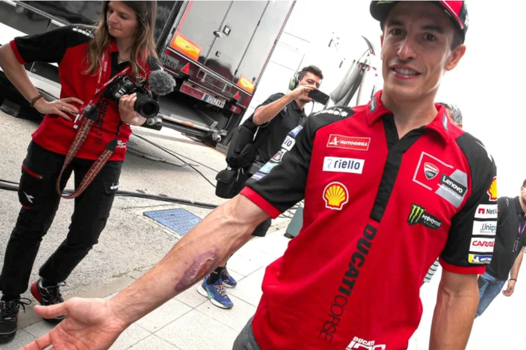 Marc Marquez Dapat Lampu Hijau, Siap Gas FP1 MotoGP Italia 2026 di Mugello