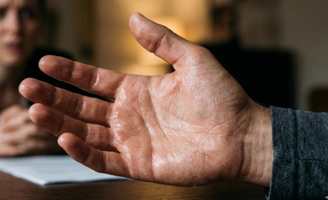 Tangan Sering Berkeringat Tanda Paru-Paru Basah dan Jantung Lemah, Mitos atau Fakta?