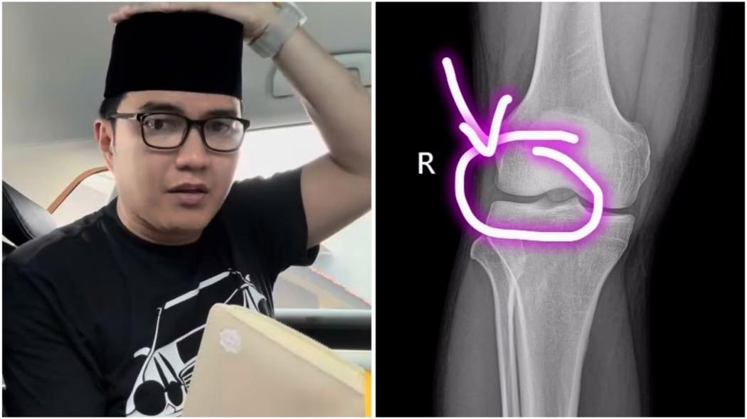 Aldi Taher Kena Pengapuran Tulang, Dengkul Sakit saat Salat