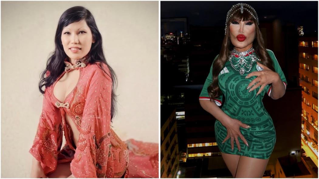 Mengerikan! Ini Efek Samping Suntik Minyak Goreng ke Wajah seperti Dialami Lyn May