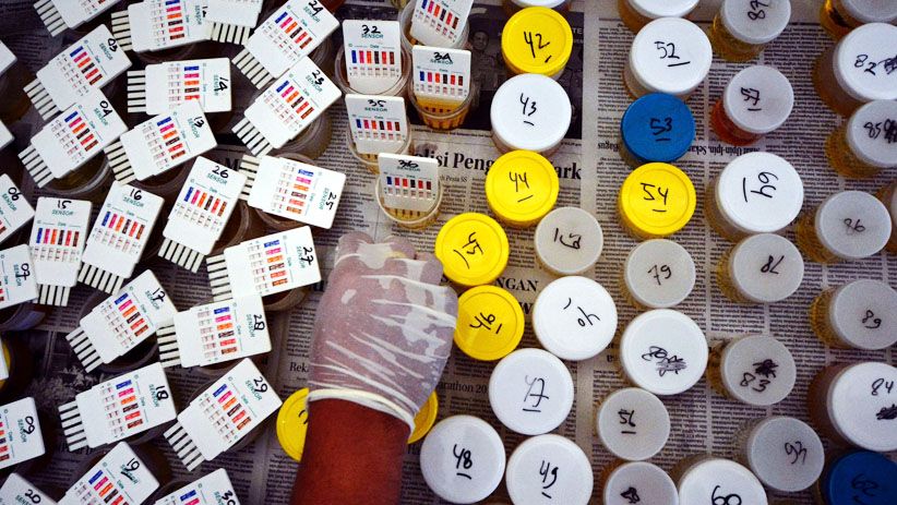 Cegah Peredaran Narkoba, Pegawai Lapas Kelas II B Purwakarta Dites Urine