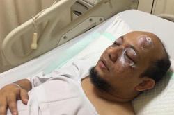 Tujuh Bulan Berlalu, Begini Kondisi Mata Novel 