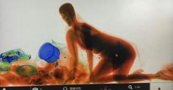 Edan, Wanita Ini Nekat Masuk Mesin X-ray karena Tak Mau Melepas Tasnya