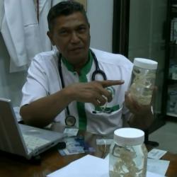 Cacing Pita Terpanjang di Dunia Ditemukan di Tubuh Warga Simalungun