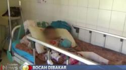 Bocah 8 Tahun di Tanjungbalai Dibakar Teman dan Disuruh Minum Air Seni
