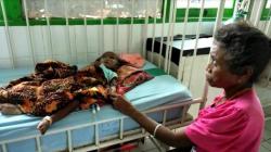 RSUD Kota Soe Rawat 8 Pasien Gizi Buruk