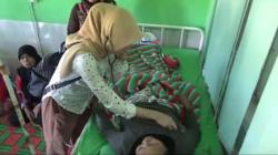 40 Warga Cianjur Keracunan Ikan Pindang saat Perpisahan Sekolah, 2 Tewas<