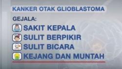 Video Grafis Gejala dan Penyebab Kanker Otak Glioblastoma yang Diderita Agung Hercules