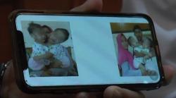 70 Dokter Tangani Operasi Bayi Kembar Siam Akila dan Azila di RSUD dr Soetomo<