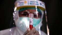 Dinkes KBB Harap-harap Cemas, Hasil Swab Test 120 ASN Kontak Erat Belum Keluar