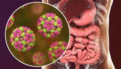 Fakta-Fakta Norovirus, Virus Mematikan Pemicu Infeksi Usus Akut