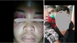Terbakar Cemburu, Seorang Pria di Tasikmalaya Culik dan Aniaya Pacar<