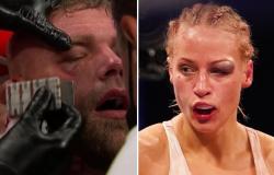Ejek Mata Bonyok Petinju Billy Joe Saunders, Si Seksi Ebanie Bridges Dihujat
