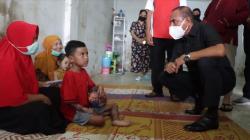 Edy Rahmayadi Temui Kakak Adik di Medan Idap Penyakit Kulit Aneh di Sekujur Tubuh