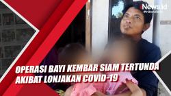 Video Operasi Pemisahan Bayi Kembar Siam di Lombok Timur Tertunda akibat Lonjakan Covid-19