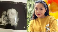 Nagita Slavina Unggah Foto USG Wajah Calon Bayi di Kandungan, Netizen: Hidungnya Mancung Sekali 