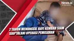 Video Bayi Kembar Siam Siap Jalani Operasi Pemisahan setelah 2 Tahun Menunggu