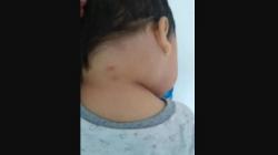 Geger Mahluk Misterius Gigit Balita hingga Tewas, Sang Ibu Curhat di Medsos