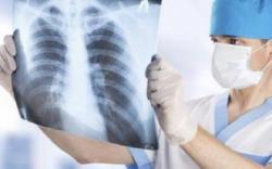 Jangan Sepelekan Tuberkulosis, Deteksi sejak Dini dan Disiplin Minum Obat 