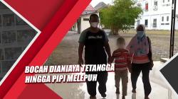 Video Bocah di Cirebon Dianiaya Tetangga hingga Pipi Melepuh, Keluarga Lapor ke KPAID
