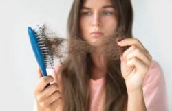 7 Cara Mengatasi Rambut Rontok, Salah Satunya Konsumsi Multivitamin