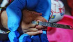 Bikin Ngilu, Begini Momen Damkar Potong Cincin yang Tersangkut di Jari Anak Kecil