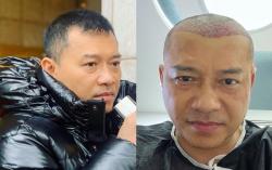  Anang Hermansyah Transplantasi Rambut, Netizen Sebut Malah Mirip Raul Lemos