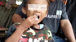 Bocah di Cianjur Ngemil Papir Satu Pak per Hari selama 5 Tahun