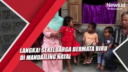 Langka! Sekeluarga Bermata Biru Tak Bisa Mendengar dan Bicara di Mandailing Natal