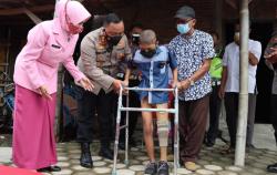 Momen Haru Kapolres Demak Beri Kaki Palsu ke Bocah yang Diamputasi akibat Kanker Tulang