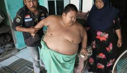 Potret Penderita Obesitas Asal Bekasi, Umur 11 Tahun Berat Badan 115 Kg