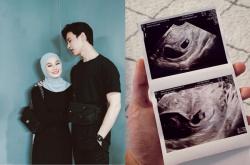Janin Anak Kembar Dinda Hauw dan Rey Mbayang Keguguran, Ini Penyebabnya!