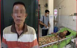 Gegara Ngaku Janda, Perempuan Ini Disiram Air Panas oleh Suami