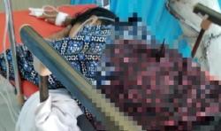 Siti Badriah Dibegal saat Berkendara, Senjata Tajam Masih Menancap di Punggung