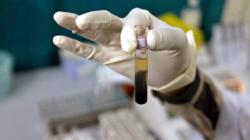 Hepatitis Akut Misterius Merebak, Kebersihan Kunci Utama Pencegahan! 
