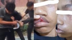Viral Video Remaja di Cimahi Dikeroyok Temannya, Polisi Tangkap 2 Pelaku<