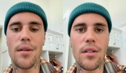 Batalkan Konser, Justin Bieber Umumkan Alami Kelumpuhan Wajah hingga Tak Bisa Senyum!
