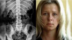 Natasha Demkina, Wanita dengan Mata Berkemampuan X-Ray Asal Rusia