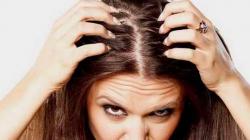 Atasi Ketombe di Rambut Kepala, 3 Cara Berikut Bisa Dicoba